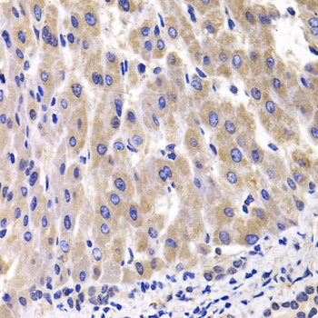 RPL14 Antibody