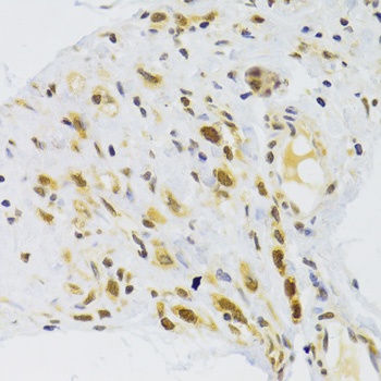 RPL13 Antibody