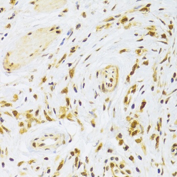 RPL13 Antibody