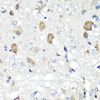 RBP2 Antibody