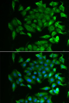 RBP2 Antibody