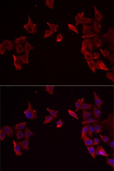 RAMP3 Antibody