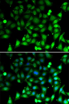 RAE1 Antibody