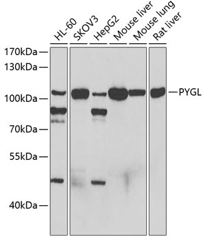 PYGL Antibody