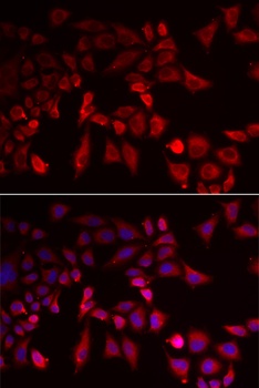PYGL Antibody