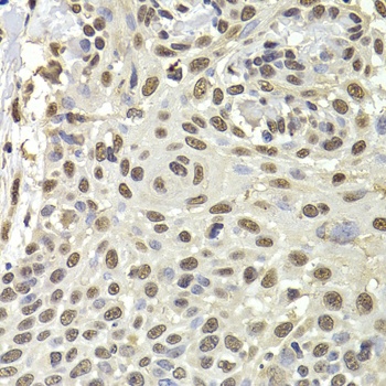 PUF60 Antibody