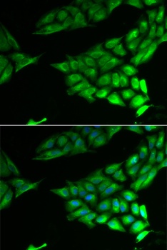 PSAT1 Antibody