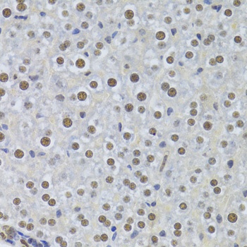 PPP1R8 Antibody