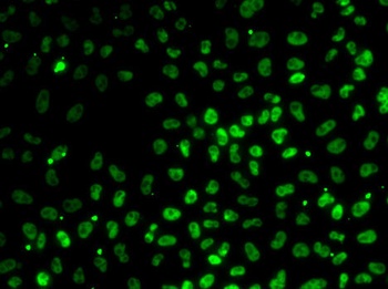 PPP1R8 Antibody