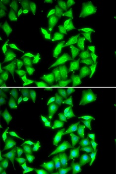 PPM1A Antibody