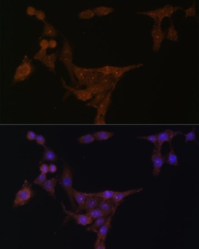 PPAT Antibody