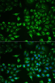 PLA2G2D Antibody