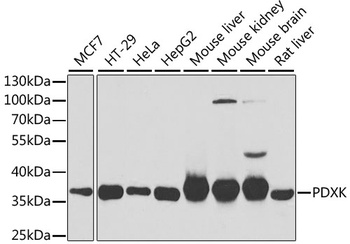 PDXK Antibody