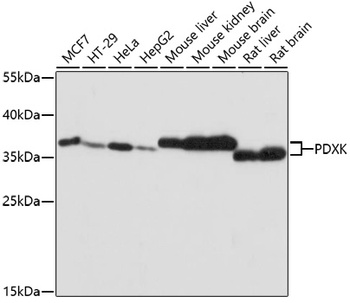 PDXK Antibody