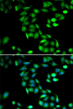 PDCD6 Antibody