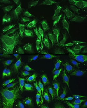 OGN Antibody