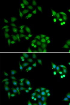 NSFL1C Antibody