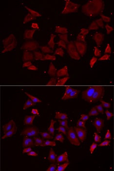 NPHP1 Antibody