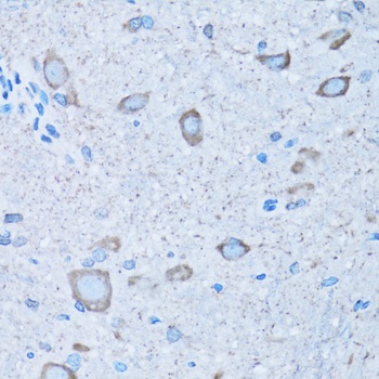 NNMT Antibody