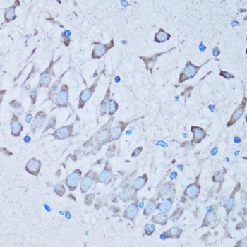 NNMT Antibody