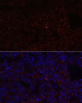 NNMT Antibody