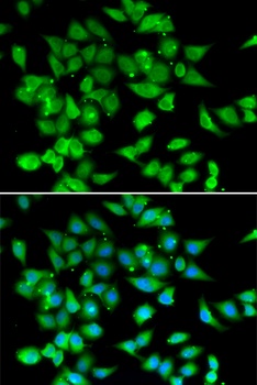 NFATC3 Antibody