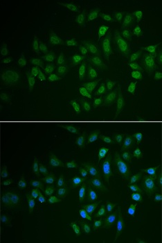 MYLK3 Antibody
