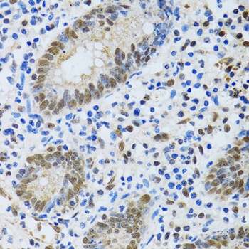 MTA3 Antibody