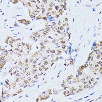 MTA3 Antibody