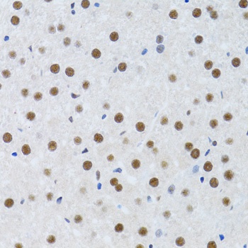 MTA3 Antibody