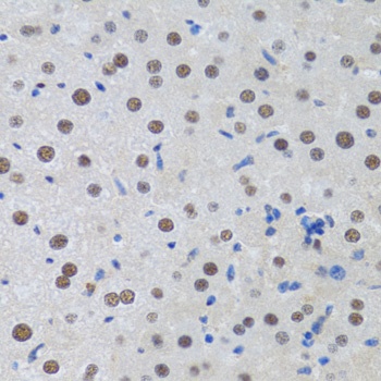 MTA3 Antibody