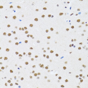 MTA3 Antibody