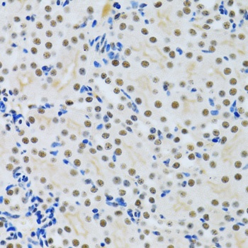 MTA3 Antibody