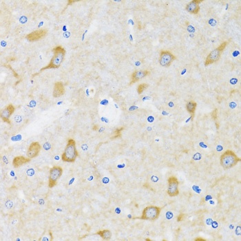 MTA3 Antibody