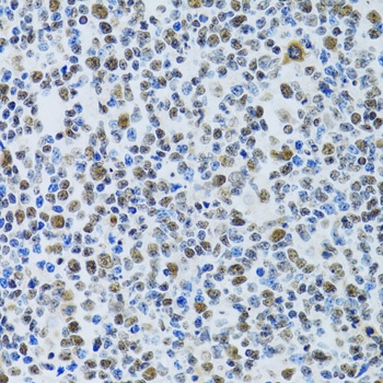 MTA3 Antibody