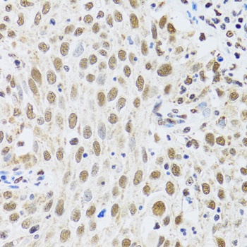 MTA3 Antibody