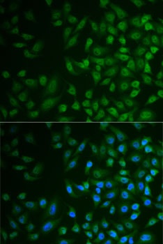 MPP2 Antibody