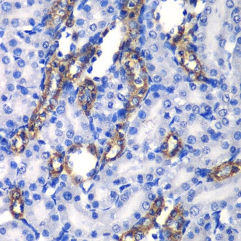 MATK Antibody