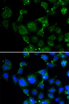 MAPRE2 Antibody