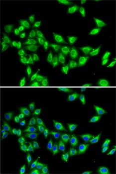 KIF3A Antibody