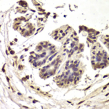 INTS6 Antibody