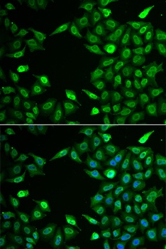 INTS6 Antibody