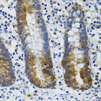 HSPH1 Antibody