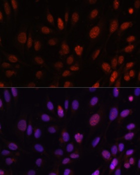 HOXB1 Antibody