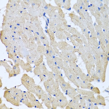 GPLD1 Antibody