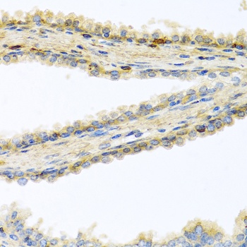 GPLD1 Antibody