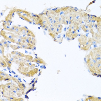 GPLD1 Antibody