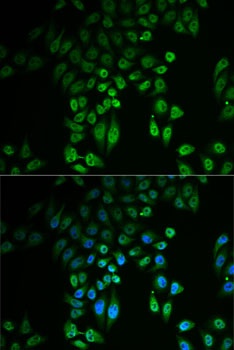 GPLD1 Antibody