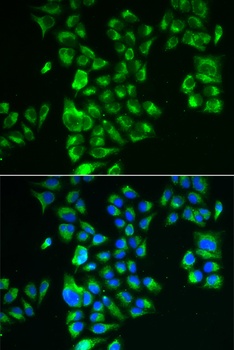 GLUD2 Antibody