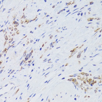 GATM Antibody